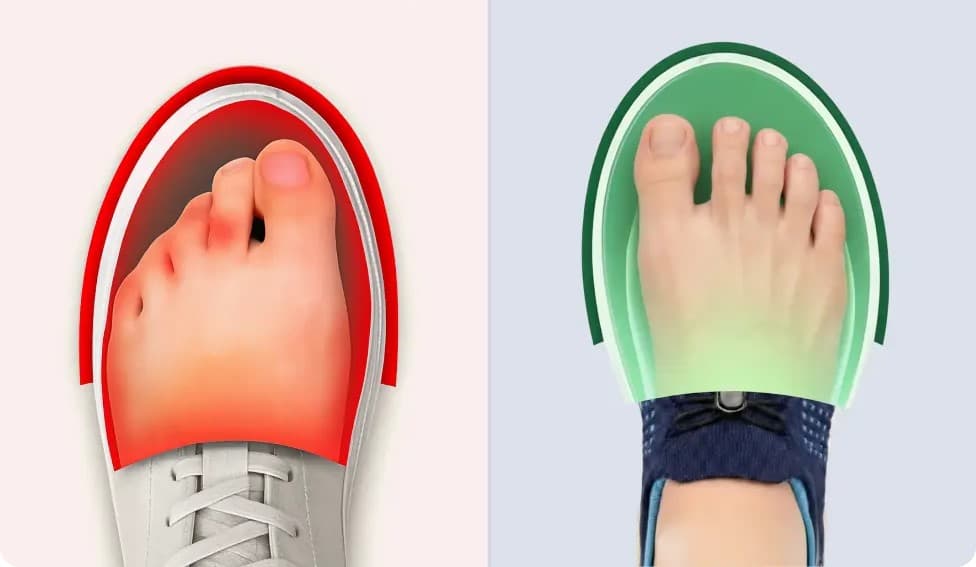 Confronto wide toe box